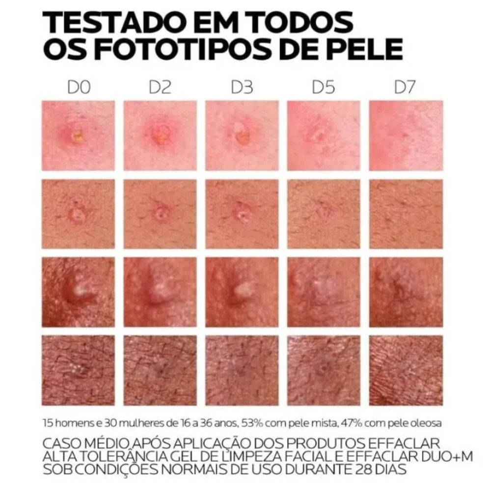 Effaclar Duo+M Creme Antiacne 40ml - La Roche-Posay