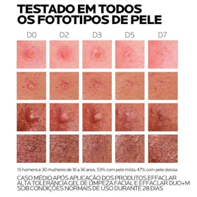 Effaclar Duo+M Creme Antiacne 40ml - La Roche-Posay
