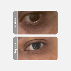 Creme Clareador para Olhos - Eye Cream 15g - Creamy